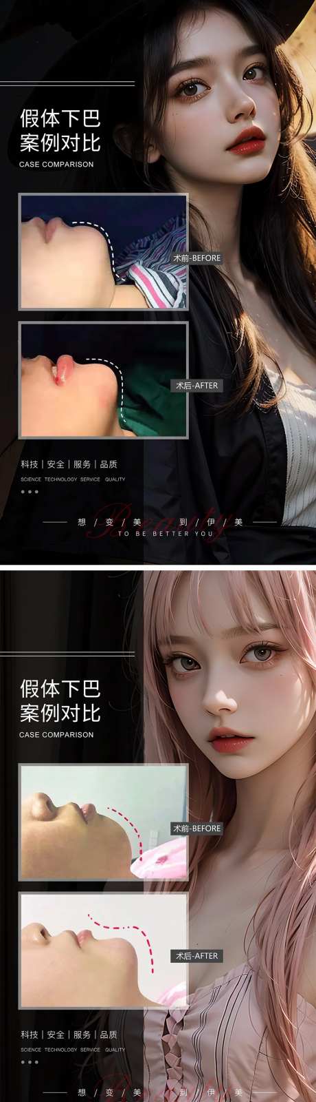 假体下巴案例对比海报-采灵感-https://www.cailinggan.com/