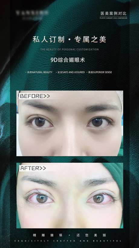 眼综合案例对比简约海报-采灵感-https://www.cailinggan.com/