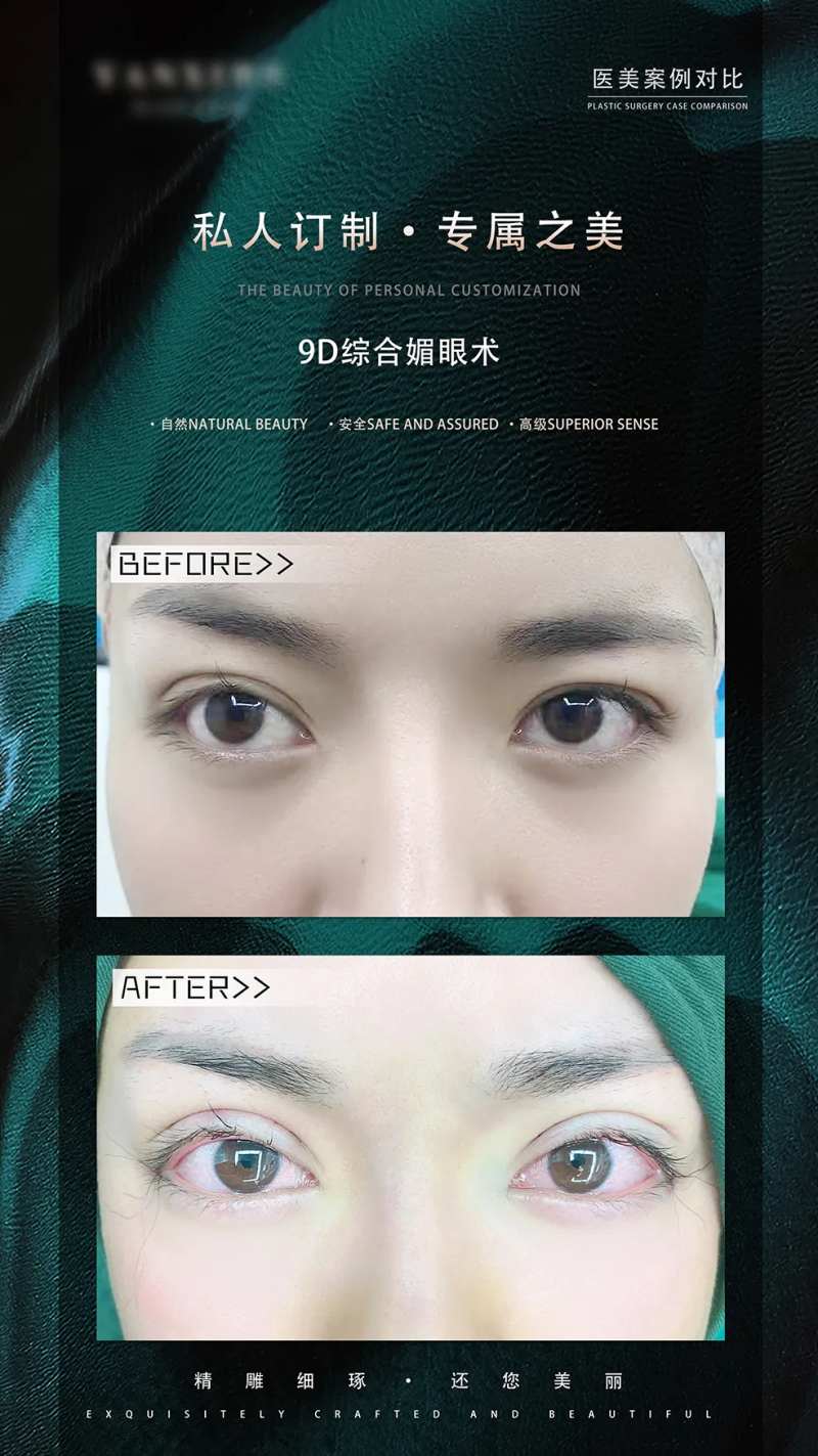 眼综合案例对比简约海报-采灵感-cailinggan.com