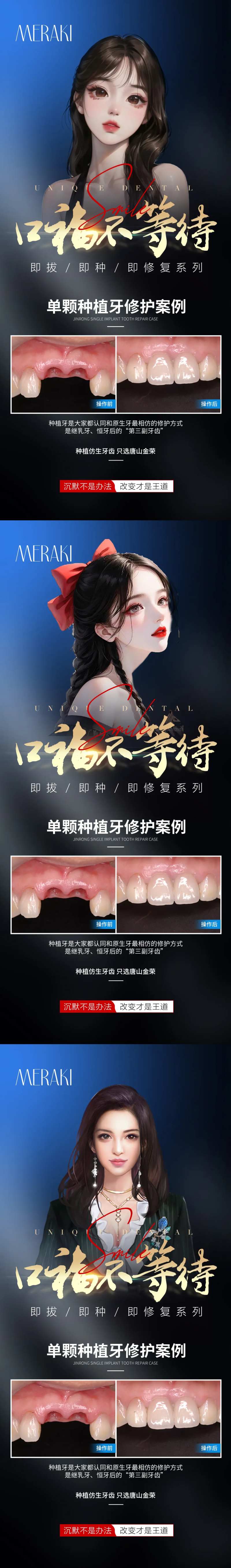 医美牙齿种植系列海报-采灵感-cailinggan.com
