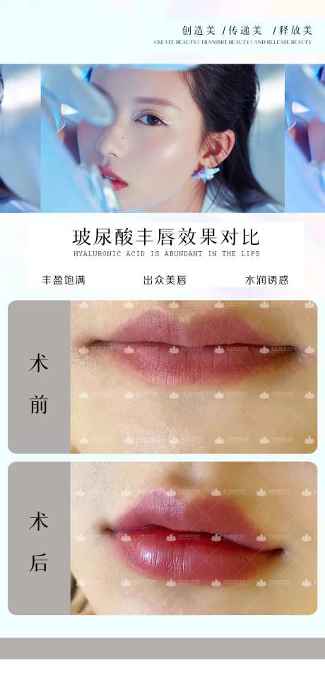 医美玻尿酸丰唇对比海报-采灵感-https://www.cailinggan.com/