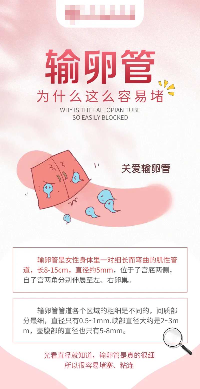 输卵管科普医疗海报-采灵感-cailinggan.com