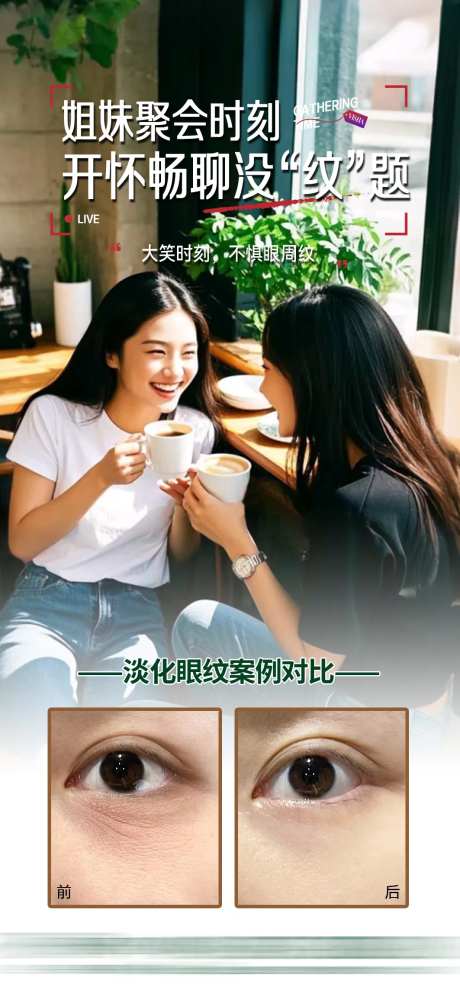 眼周皱纹-采灵感-https://www.cailinggan.com/