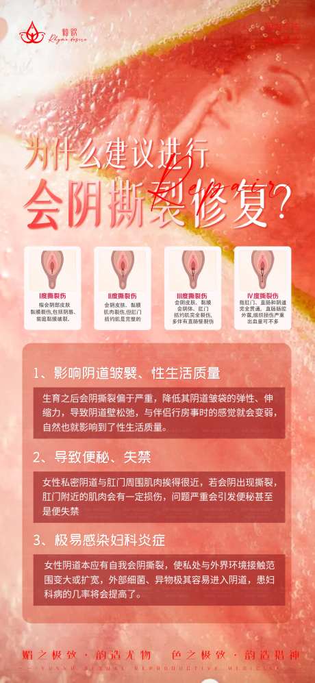 女性会阴撕裂修复-采灵感-https://www.cailinggan.com/