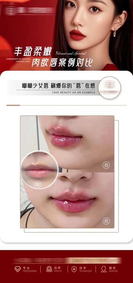 医美丰唇案例-采灵感-https://www.cailinggan.com/