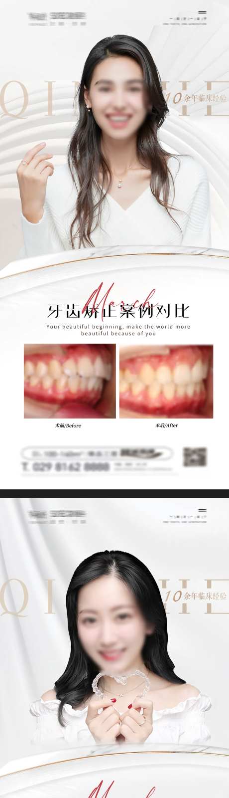 口腔牙齿矫正案例对比海报-采灵感-https://www.cailinggan.com/