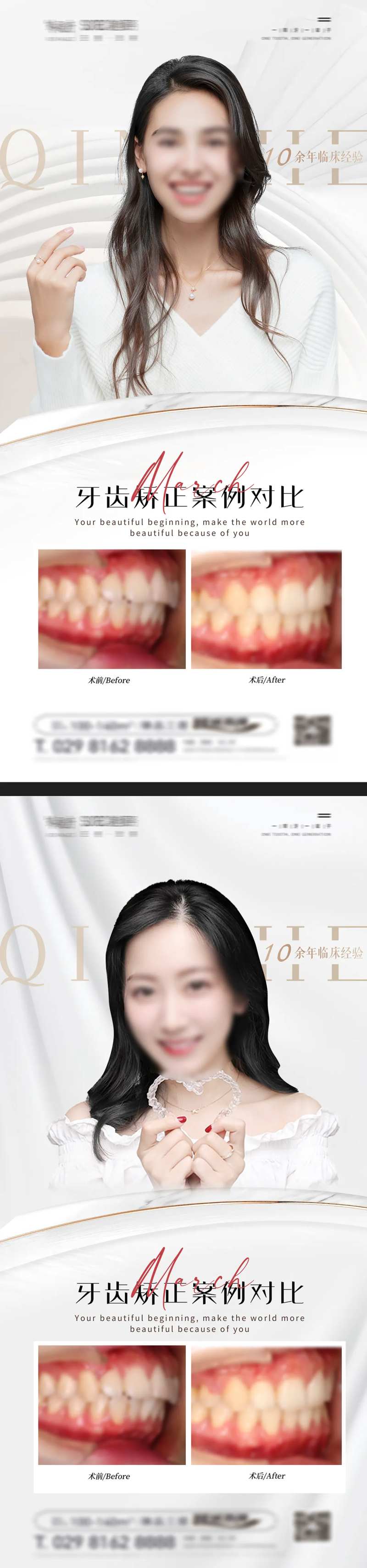 口腔牙齿矫正案例对比海报-采灵感-cailinggan.com