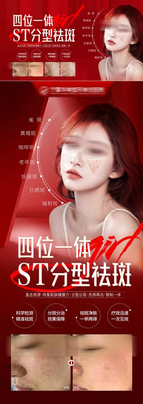 分型祛斑海报-采灵感-https://www.cailinggan.com/