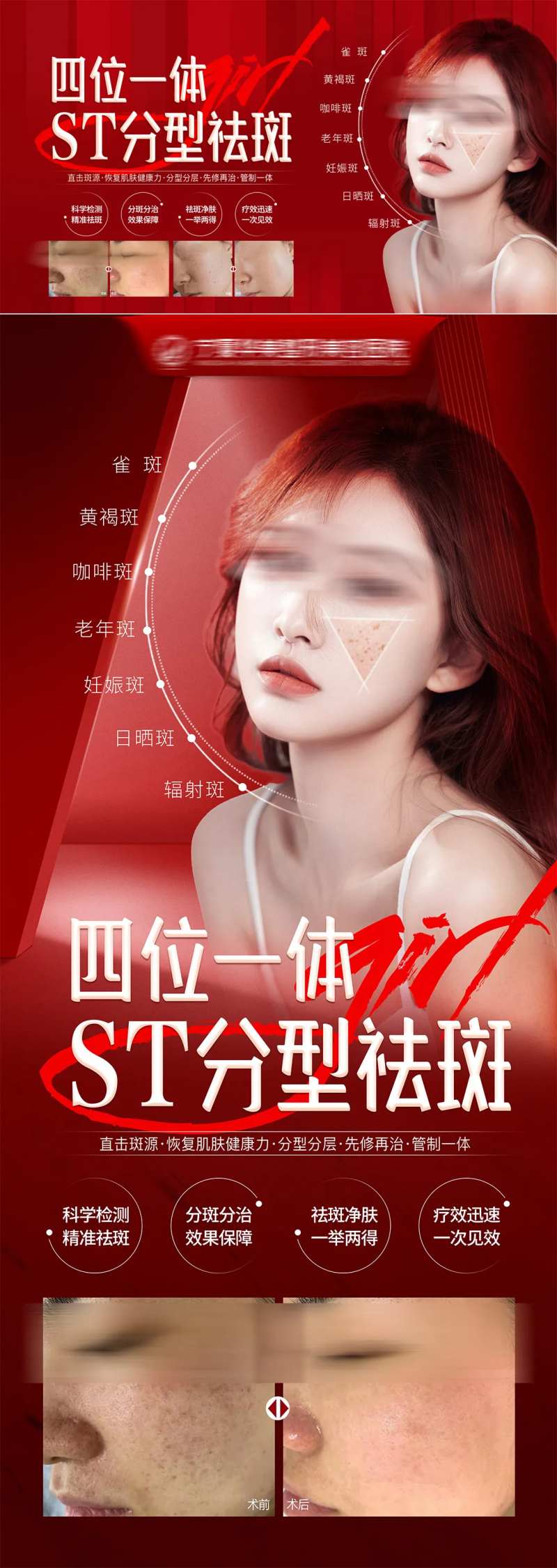 分型祛斑海报-采灵感-cailinggan.com