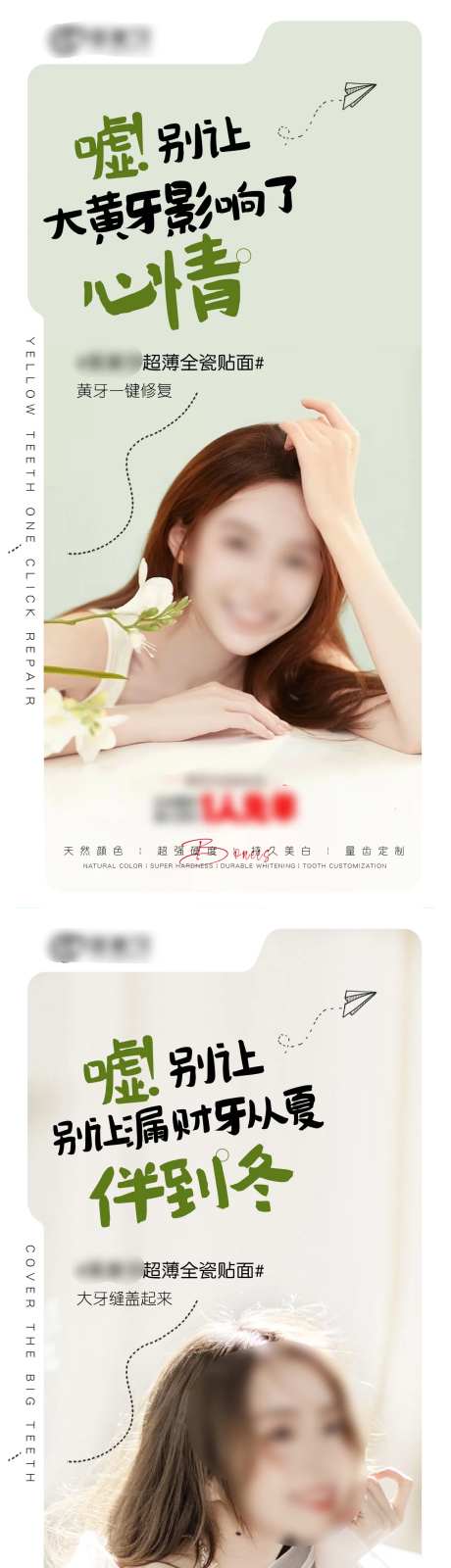口腔美学牙齿超薄全瓷贴面-采灵感-https://www.cailinggan.com/