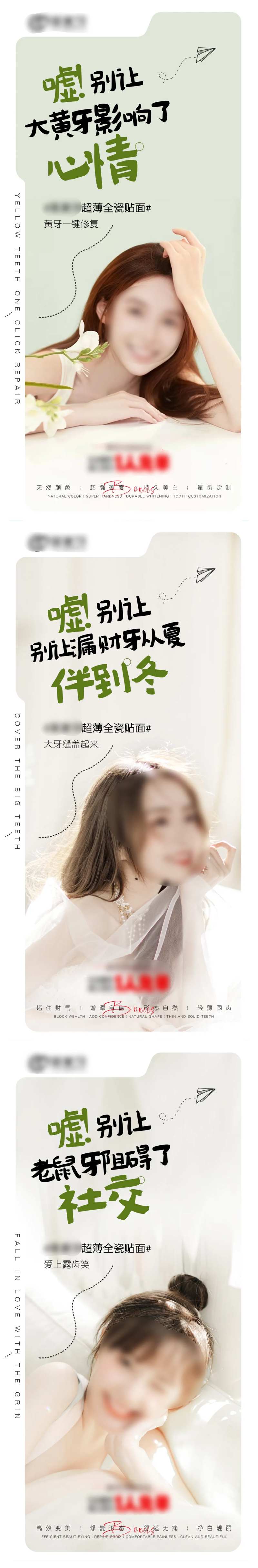 口腔美学牙齿超薄全瓷贴面-采灵感-cailinggan.com