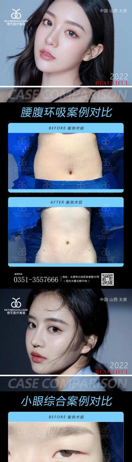 医美案例对比图-采灵感-https://www.cailinggan.com/