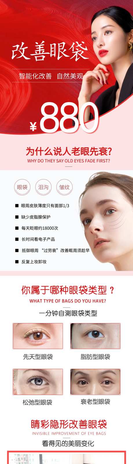 改善眼袋长图-采灵感-https://www.cailinggan.com/