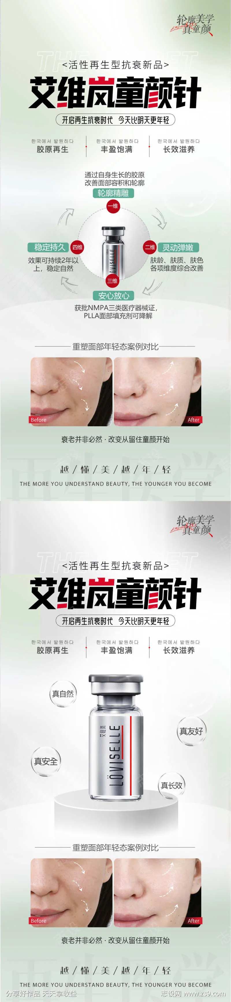 艾维岚童颜针                                                                                                                                                                                                  -采灵感-cailinggan.com