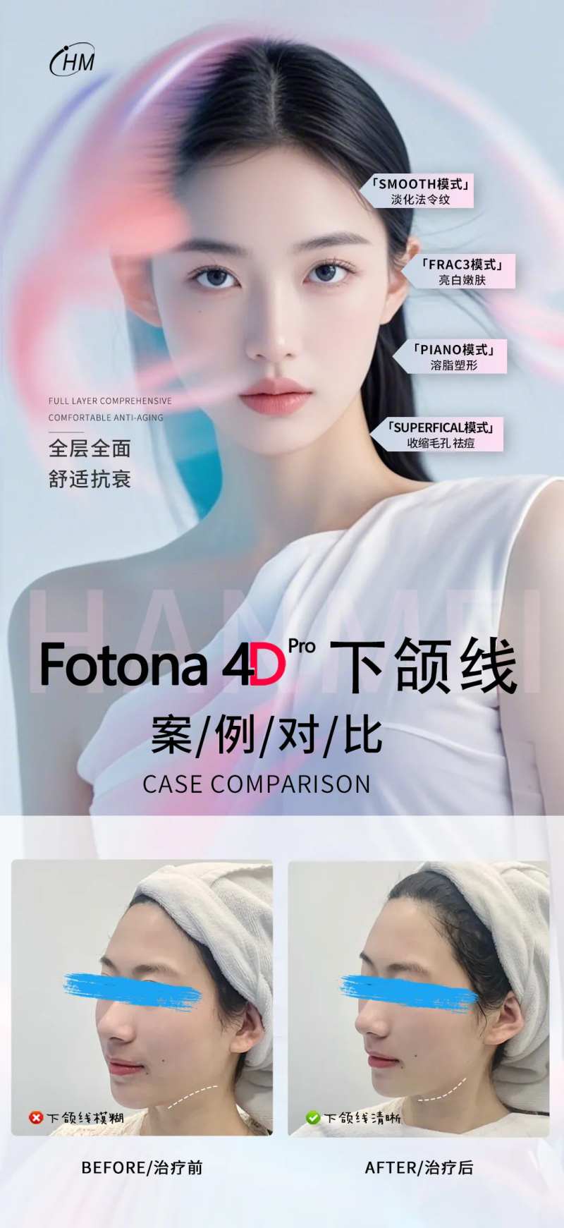 fotona4D案例对比-采灵感-cailinggan.com