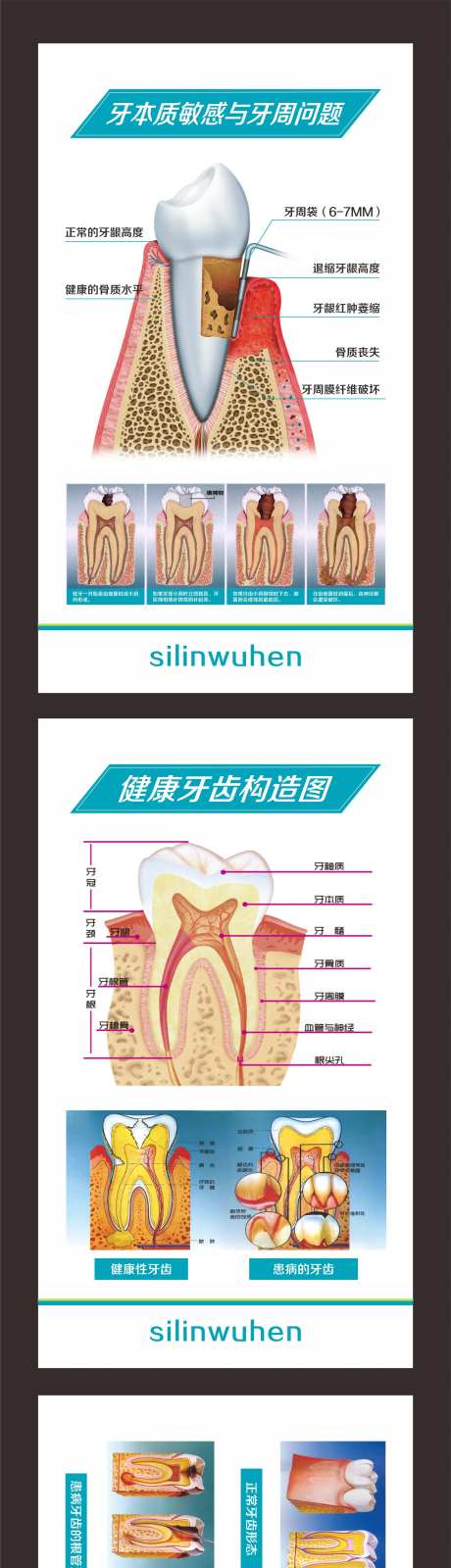 牙齿构造图系列海报-采灵感-https://www.cailinggan.com/