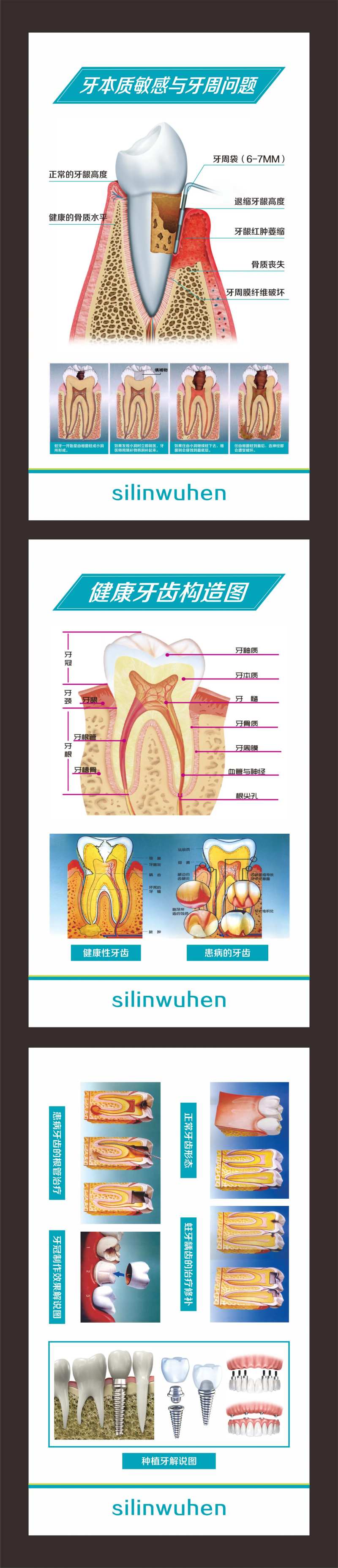 牙齿构造图系列海报-采灵感-cailinggan.com