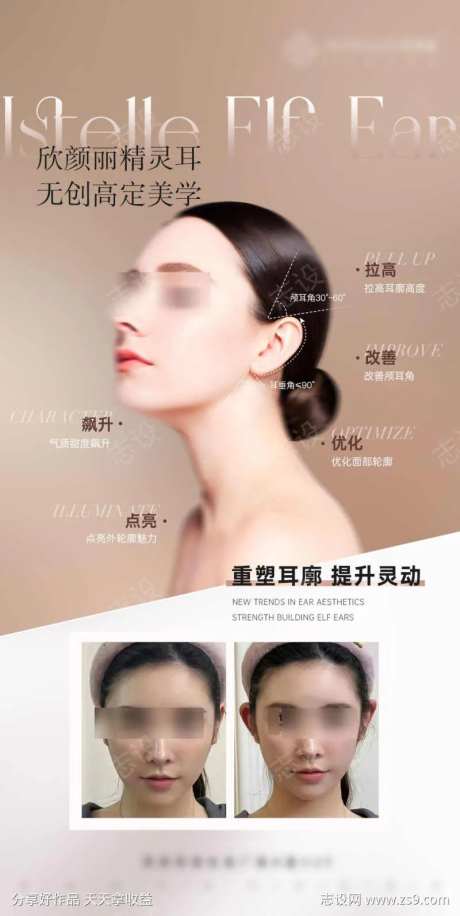 精灵耳重塑-采灵感-https://www.cailinggan.com/