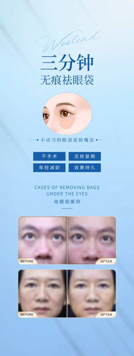 医美三分钟祛眼袋海报-采灵感-https://www.cailinggan.com/