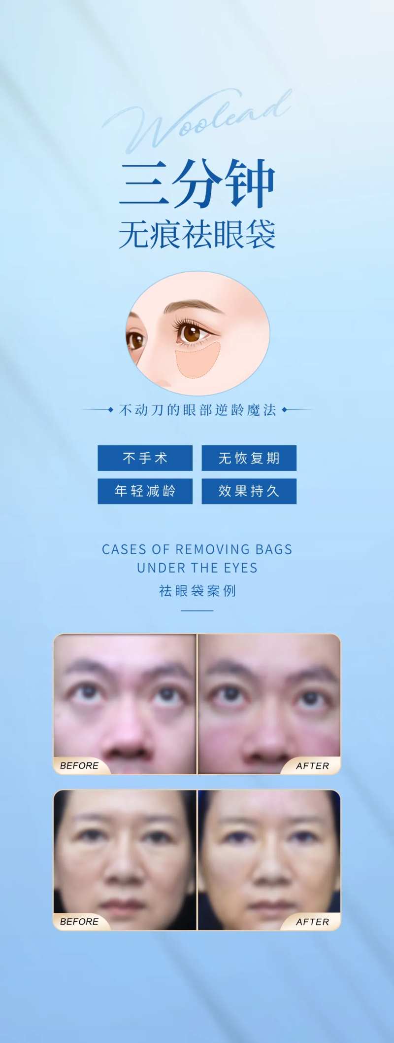 医美三分钟祛眼袋海报-采灵感-cailinggan.com