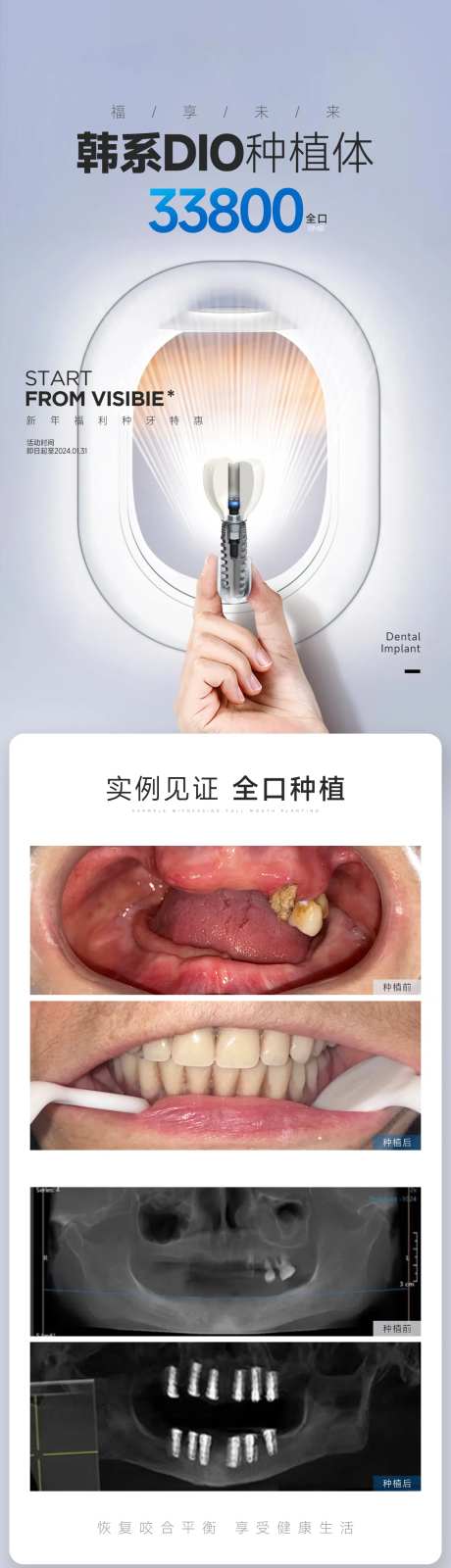 种植牙案例对比图-采灵感-https://www.cailinggan.com/