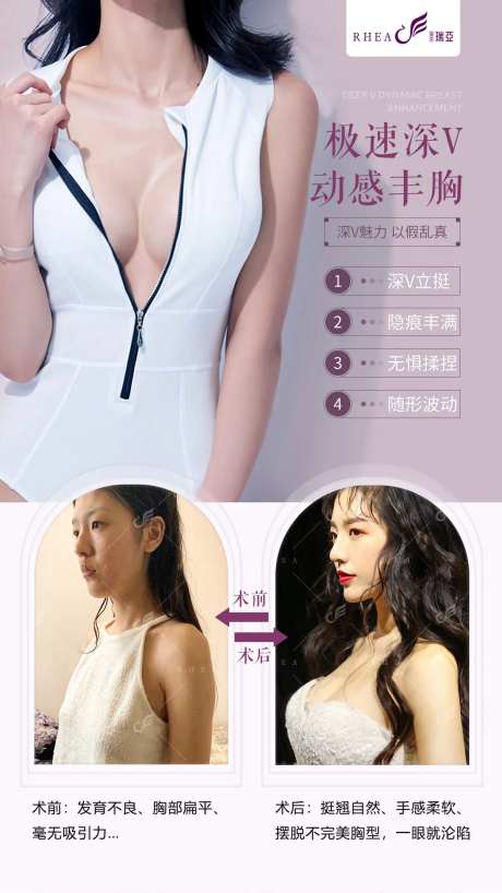 医美丰胸整形海报-采灵感-https://www.cailinggan.com/
