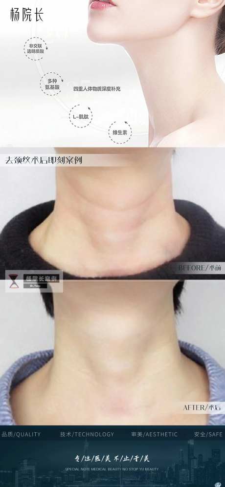 去颈纹微整形案例对比图模板可更换-采灵感-https://www.cailinggan.com/