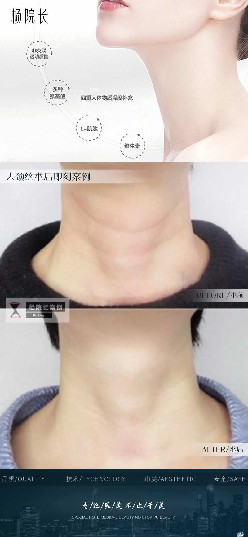 去颈纹微整形案例对比图模板可更换-采灵感-cailinggan.com