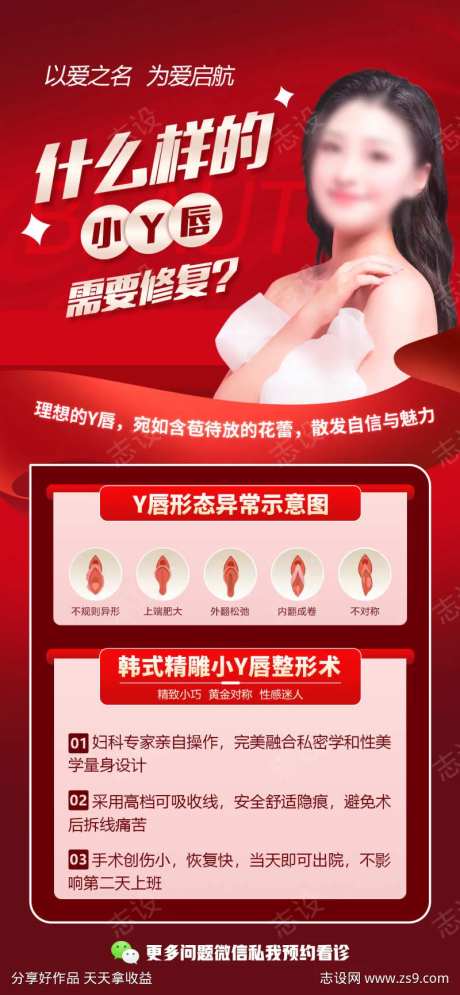 阴唇修复整形术-采灵感-https://www.cailinggan.com/