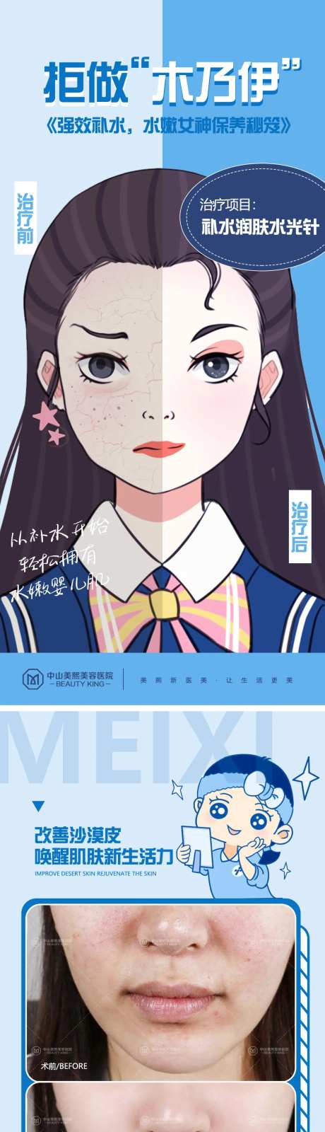医美皮肤干燥对比漫画海报-采灵感-https://www.cailinggan.com/