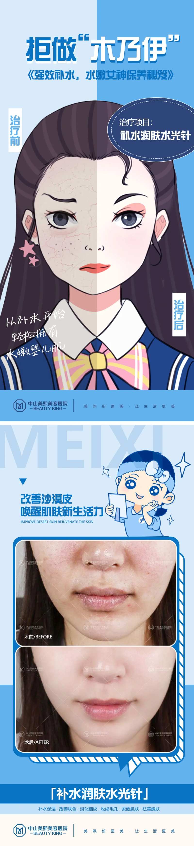 医美皮肤干燥对比漫画海报-采灵感-cailinggan.com