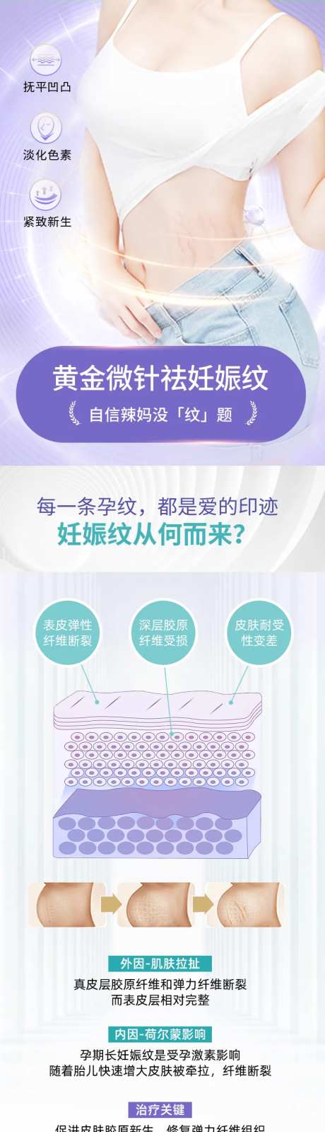 医美黄金微针祛妊娠纹-采灵感-https://www.cailinggan.com/