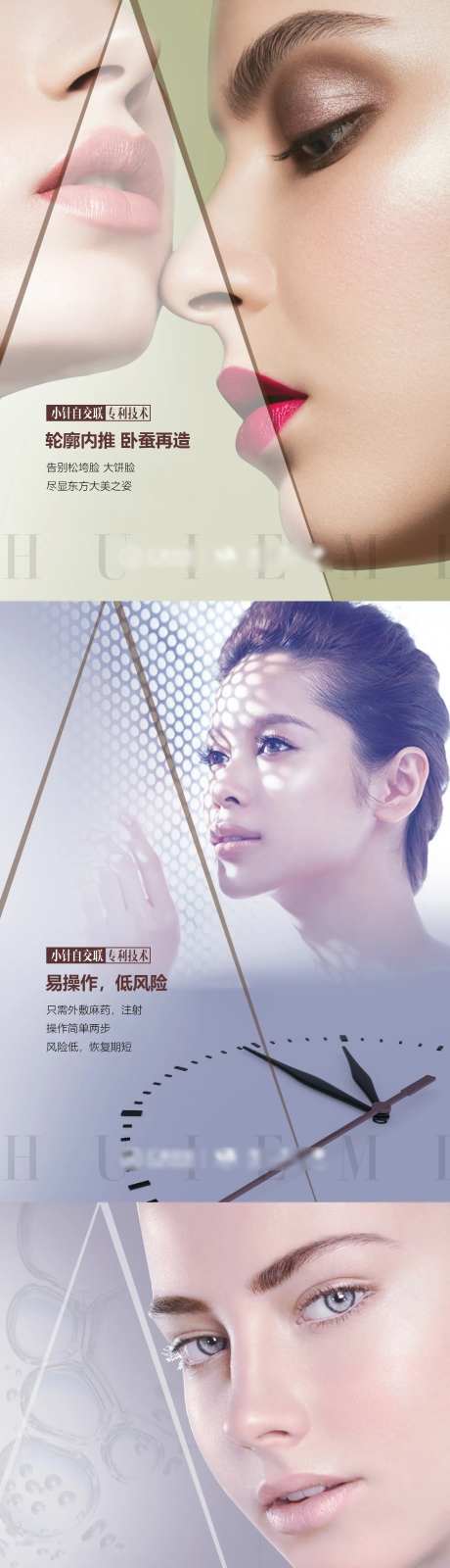 医美项目优势系列海报-采灵感-https://www.cailinggan.com/