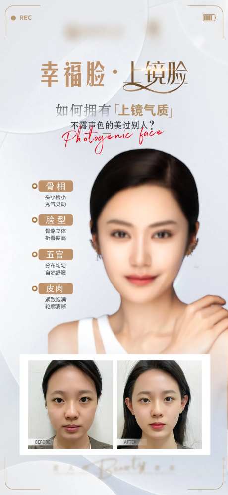 医美上镜脸活动海报-采灵感-https://www.cailinggan.com/