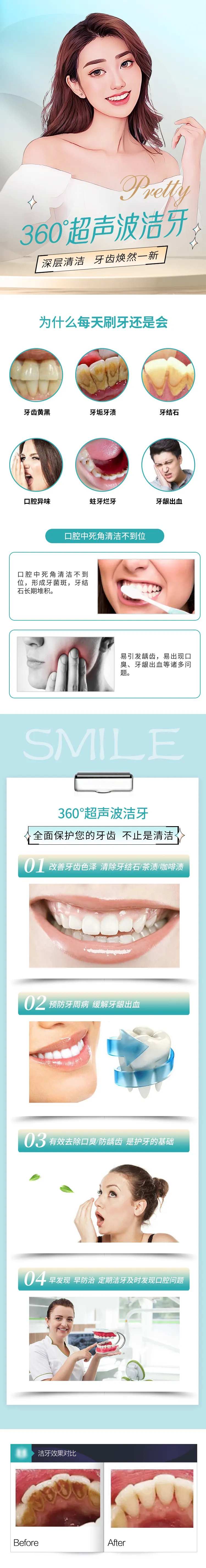 医美超声波洁牙电商详情页-采灵感-cailinggan.com