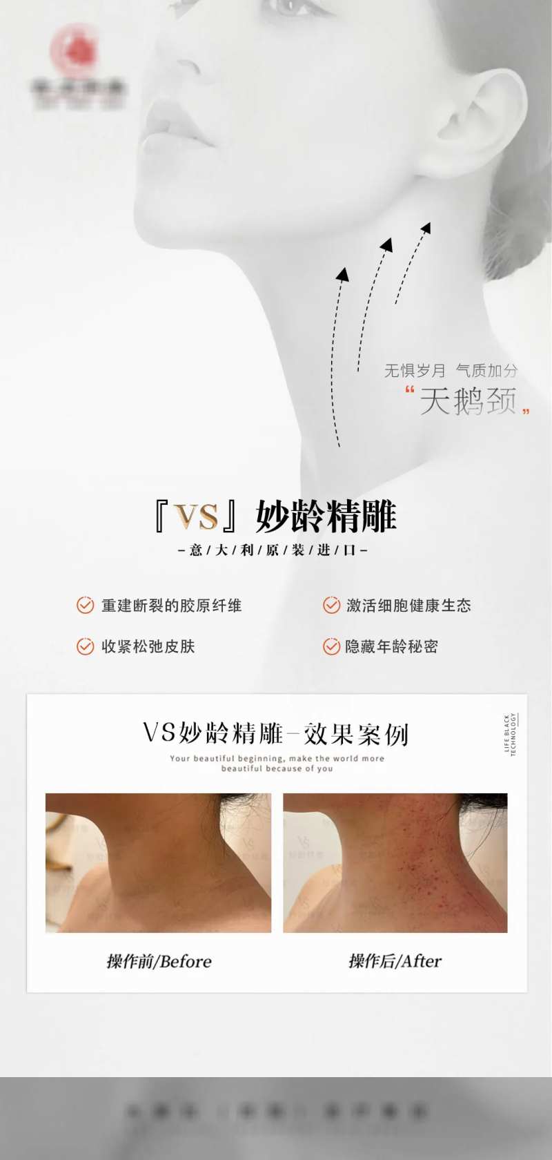 天鹅颈-采灵感-cailinggan.com