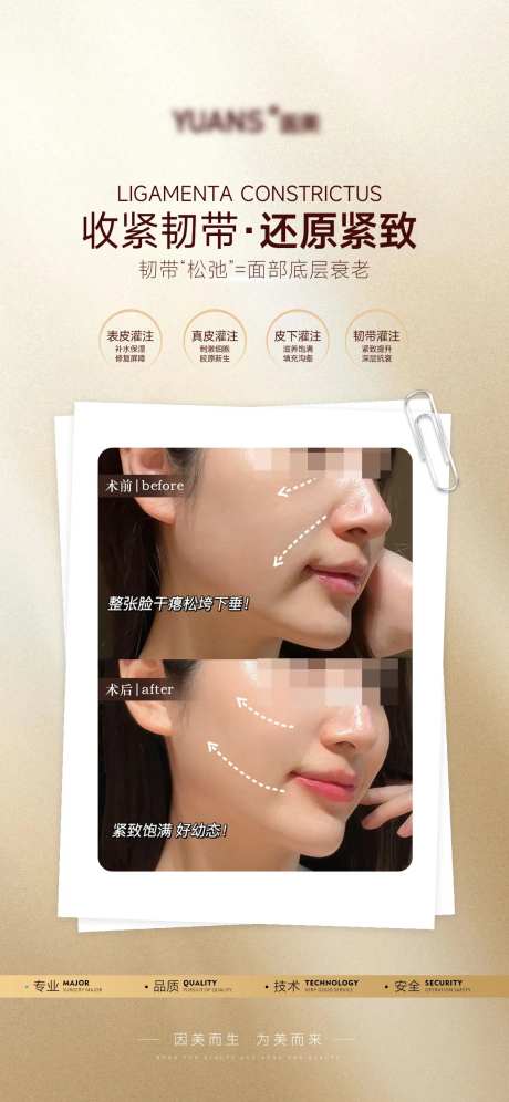 医美韧带提升案例海报-采灵感-https://www.cailinggan.com/