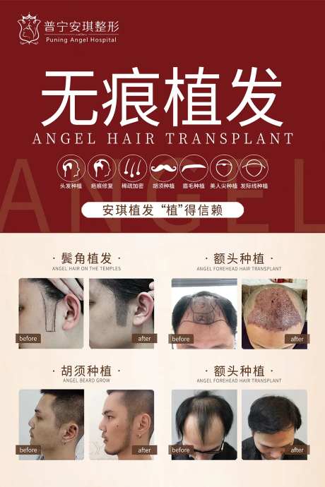 无痕植发医美海报-采灵感-https://www.cailinggan.com/