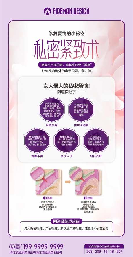 私密紧致术海报-采灵感-https://www.cailinggan.com/