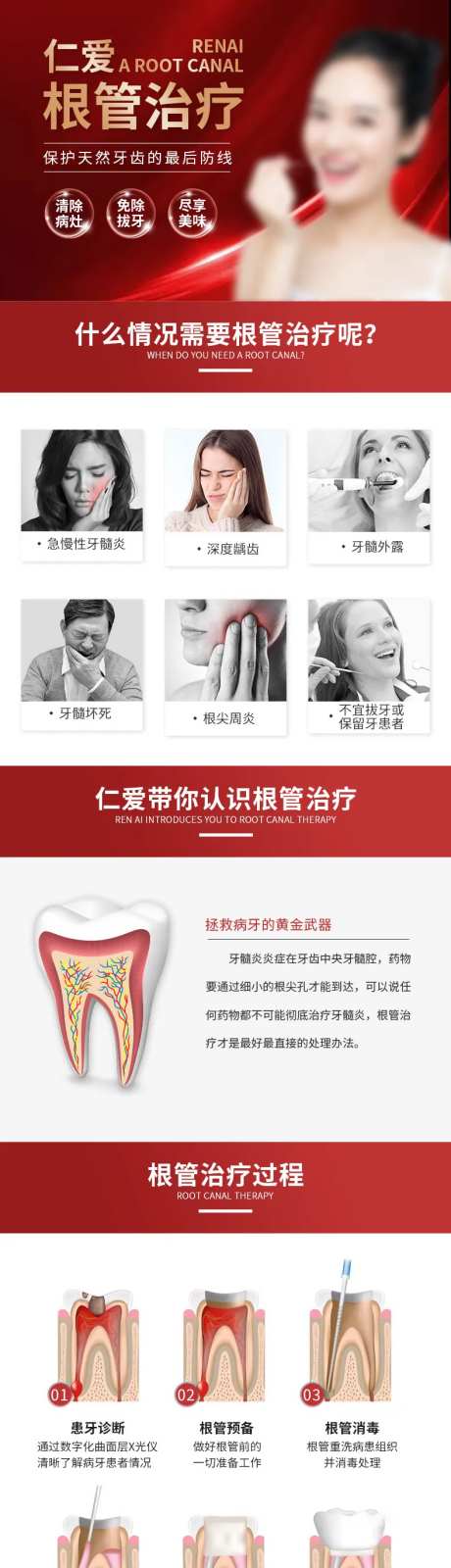 根管治疗-采灵感-https://www.cailinggan.com/