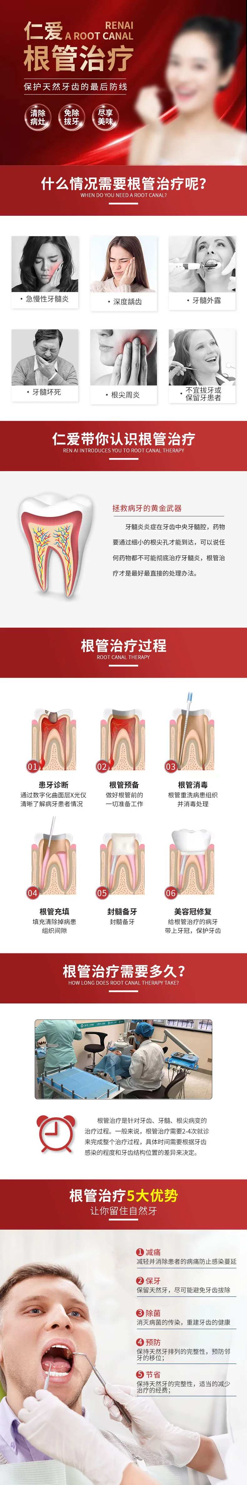 根管治疗-采灵感-cailinggan.com