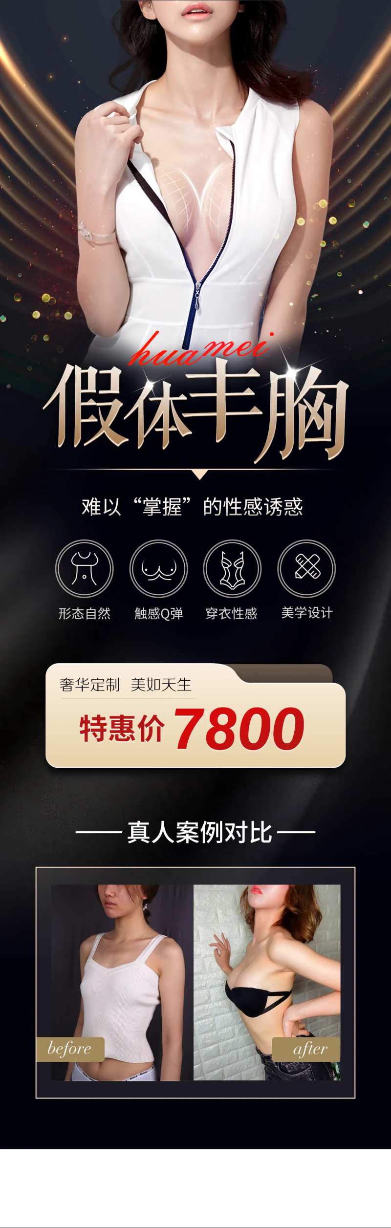 假体丰胸长图-采灵感-cailinggan.com