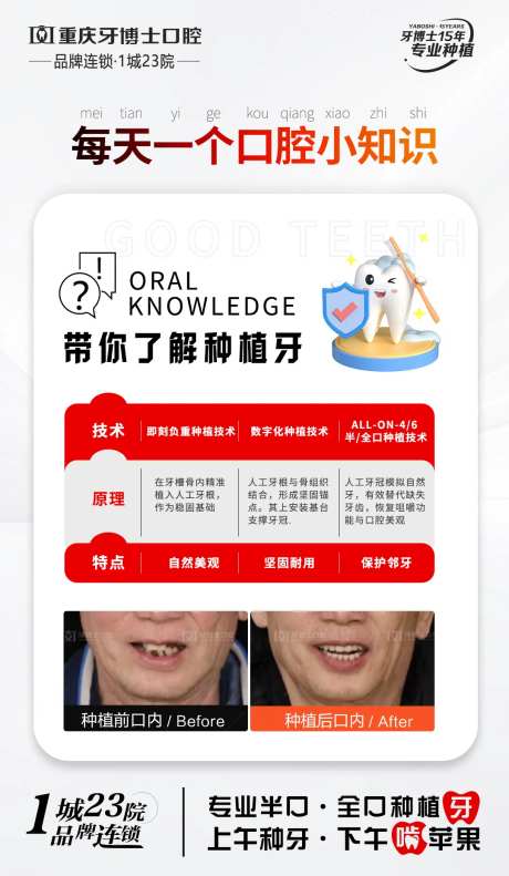 口腔种植牙科普知识-采灵感-https://www.cailinggan.com/