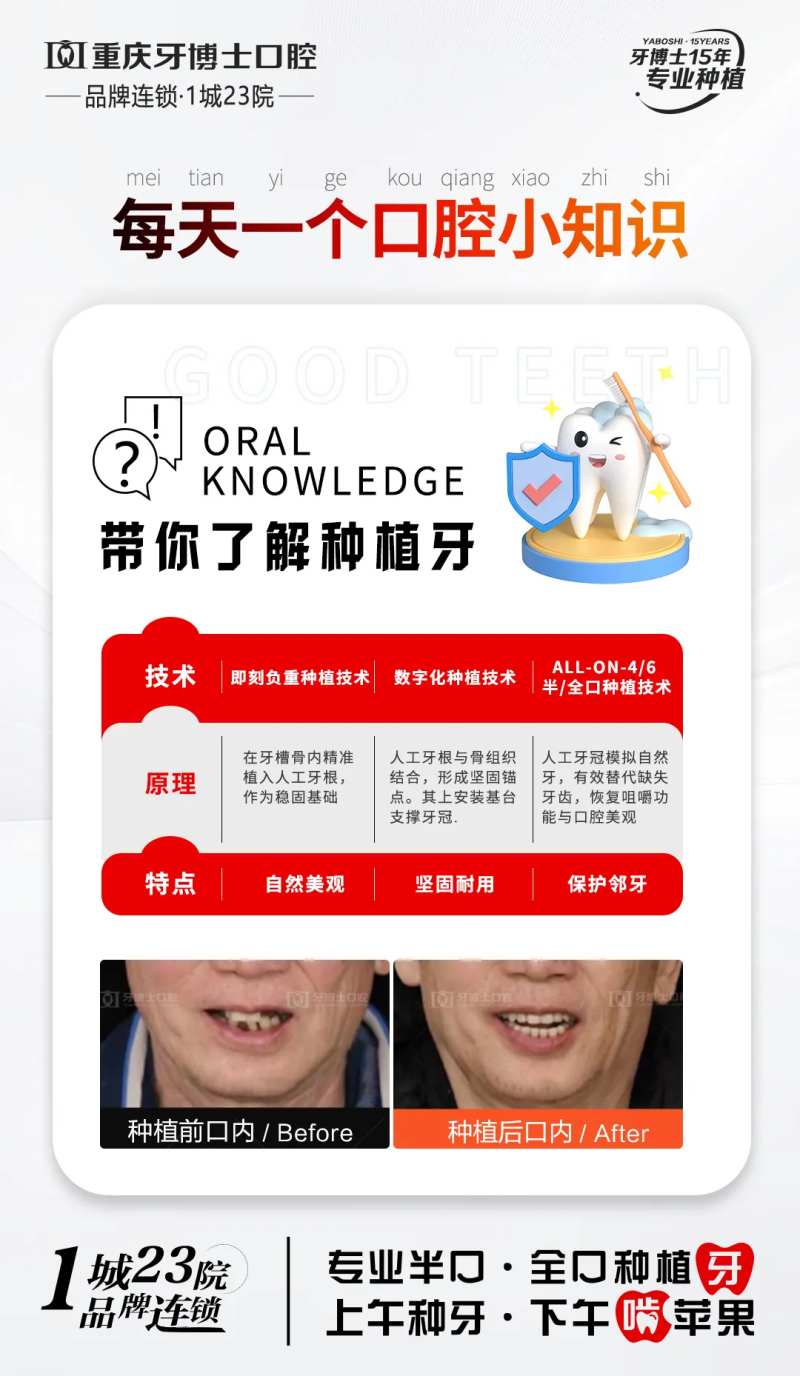 口腔种植牙科普知识-采灵感-cailinggan.com