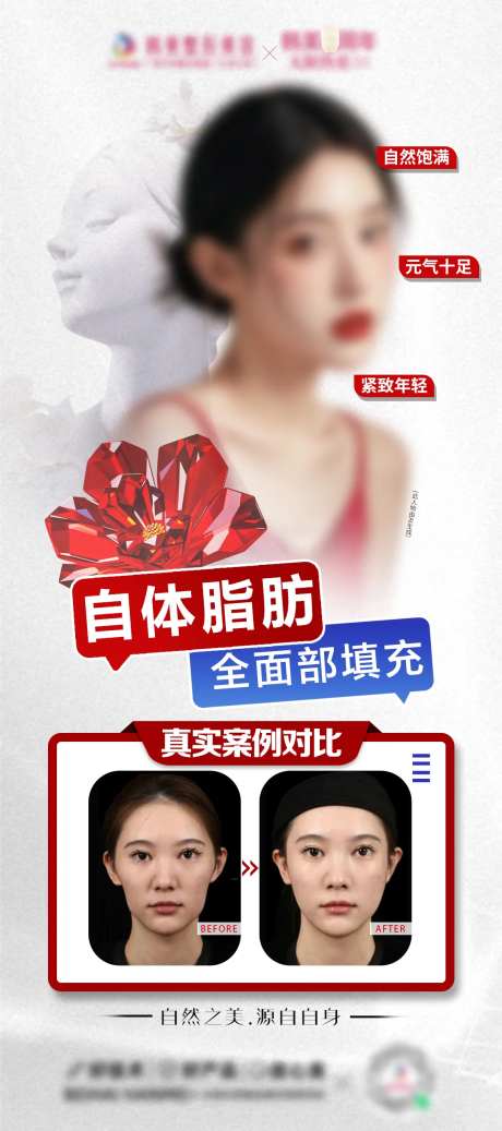 自体脂肪面部填充海报-采灵感-https://www.cailinggan.com/