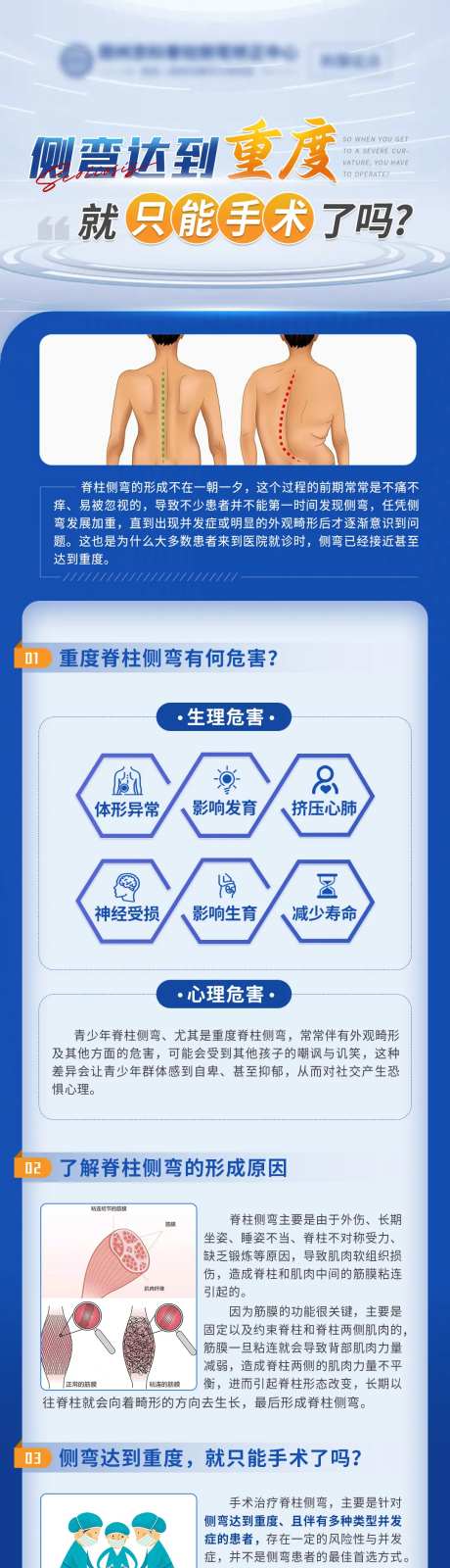 重度脊柱侧弯医疗科普-采灵感-https://www.cailinggan.com/