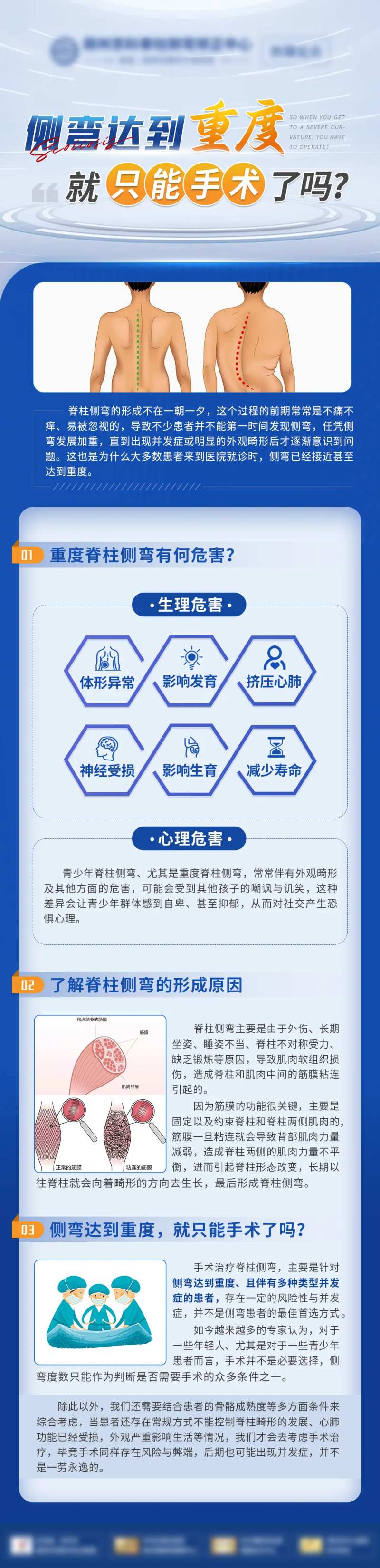 重度脊柱侧弯医疗科普-采灵感-cailinggan.com