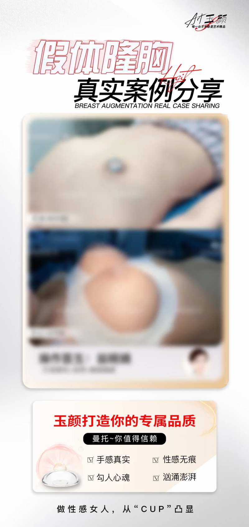 医美假体隆胸案例海报-采灵感-cailinggan.com