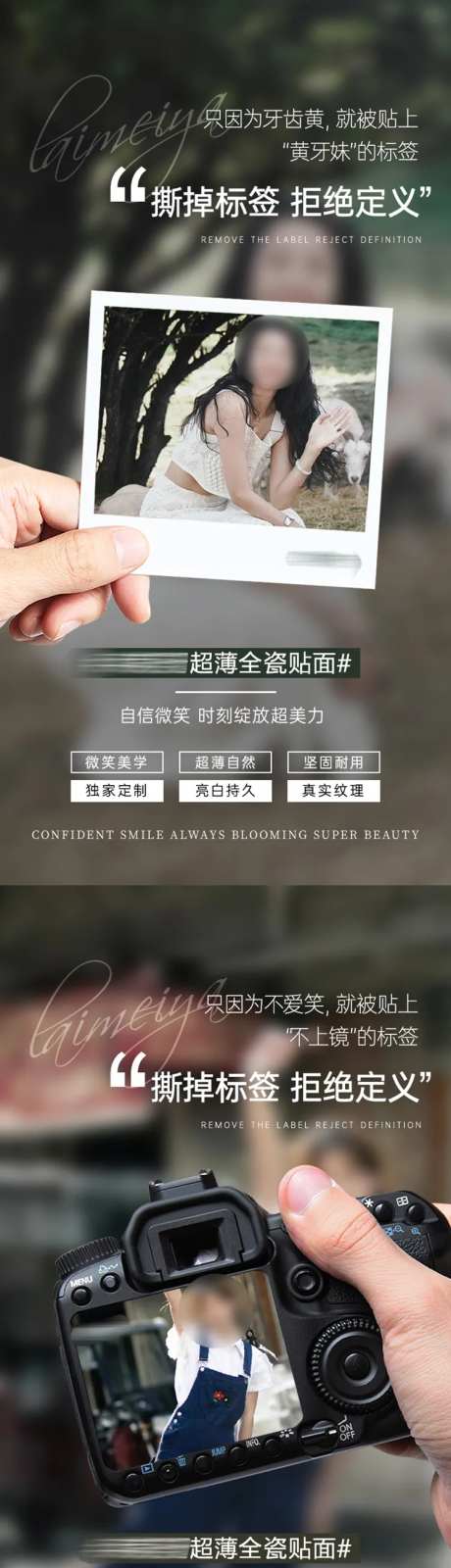 口腔美学牙齿贴面系列海报-采灵感-https://www.cailinggan.com/