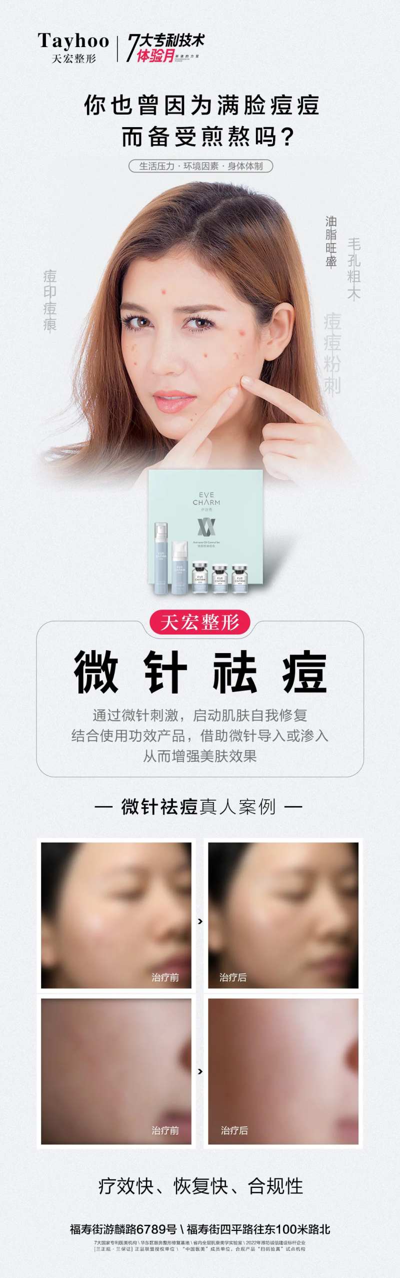 微针祛痘长图-采灵感-cailinggan.com